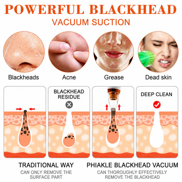 Premium Multi-Functional Black & Whitehead Remover For Pore & Pimples Cleaner Machine Men & Women